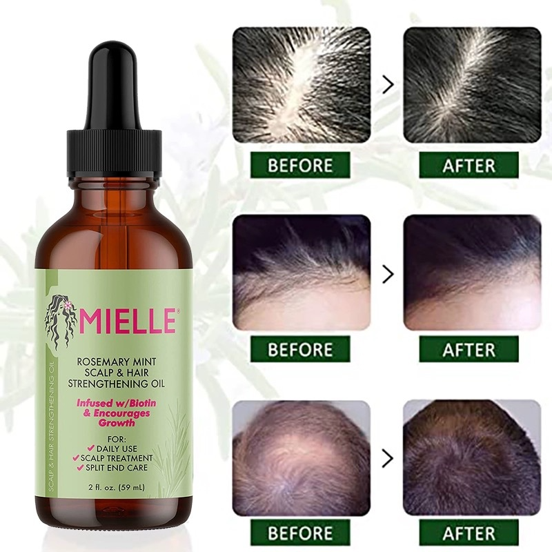 Rosemary Oil for Hair Growth Organic , Rosemary Mint Scalp & Hair Strengthening Oil with Biotin & Essential Oils,for Improves Blood Circulation,Dry Scalp Treatment,Reduce Hair Loss